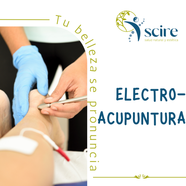ELECTROACUPUNTURA